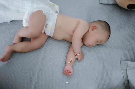 莱州孕妇肚脐周围发青